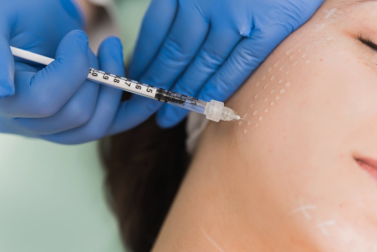 Mesotherapy treatment